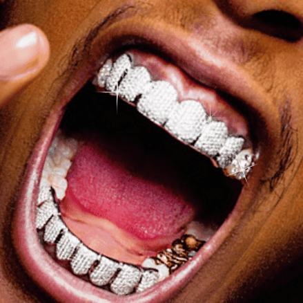 Custom Grillz Order - Deposit - Johnny Dang & Co