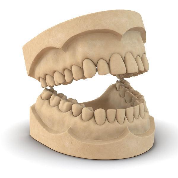 Easy DIY Dental Molding kit and Instructions-2 Kits - Johnny Dang & Co
