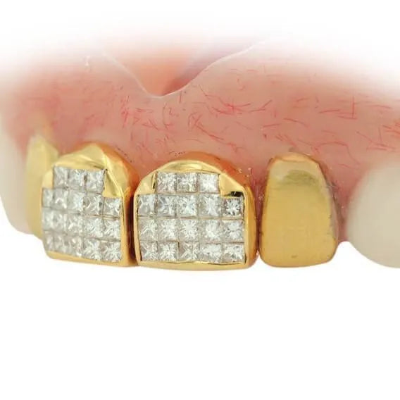 18k Permanents for Dentures
