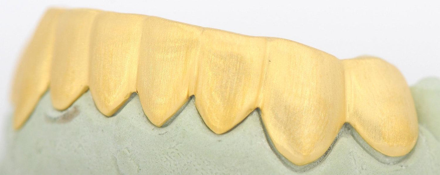 JDTK-S161706-1A 6 Teeth Sand Finish - Johnny Dang & Co