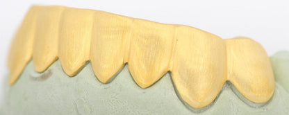 JDTK-S161706-1A 6 Teeth Sand Finish - Johnny Dang & Co