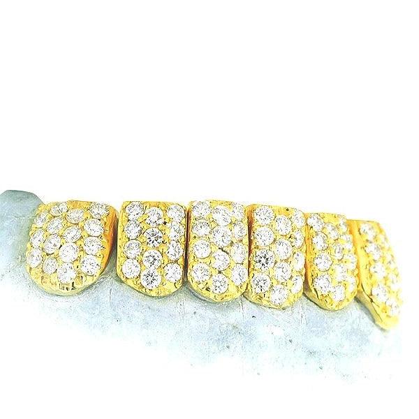 JDTK-S151806-2-NEW -18K Individual Diamond Prong Set Permanent Teeth - Johnny Dang & Co