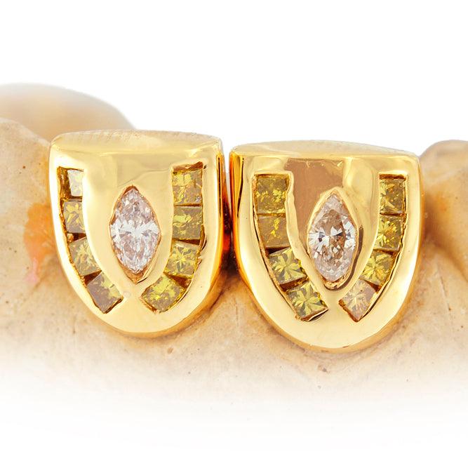 JDTK-S160103-1 18K INDIVIDUAL CHANNEL SET DIAMOND GRILL - Johnny Dang & Co