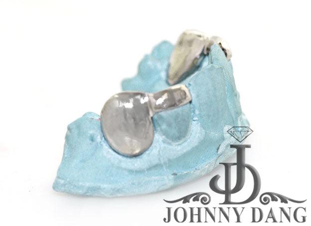 JDTK-S2530023 Gold teeth - Johnny Dang & Co