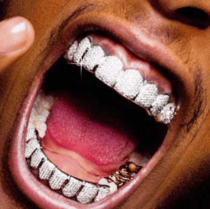 Custom Grillz Order - Deposit - Johnny Dang & Co