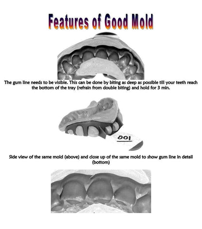 Easy DIY Dental Molding kit and Instructions-Single Kit - Johnny Dang & Co