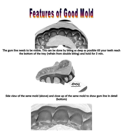 Easy DIY Dental Molding kit and Instructions-2 Kits - Johnny Dang & Co